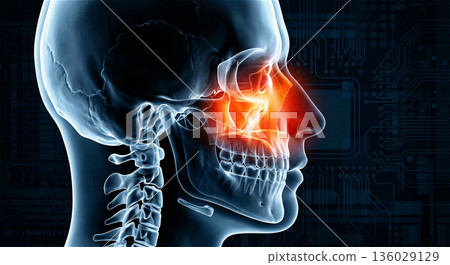 鼻腔發炎影像插圖 花粉症 鼻炎 過敏 骨骼 X光片 3DCG 標籤 136029129
