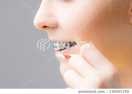 Woman smiling cleaning teeth with braces 136045249