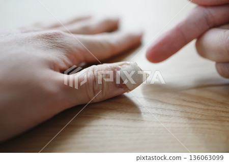 特寫鏡頭：一隻手，受傷的大拇指上纏著繃帶。 136063099