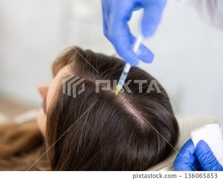 Hands of trichologist performing injections into scalp to female patient 136065853