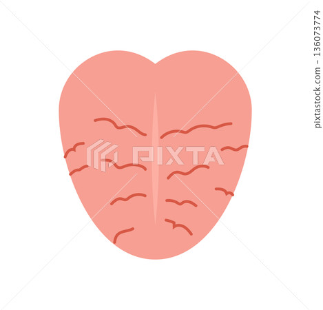 cracked tongue 136073774