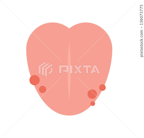 Tongue with a red rash 136073775