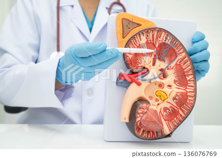 Chronic kidney disease, doctor with model for treatment urinary system, urology, Estimated glomerular filtration rate eGFR. Chronic kidney disease, doctor with model for treatment urinary system, urology, Estimated glomerular filtration rate eGFR. 136076769
