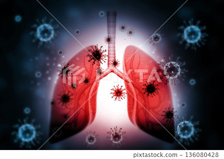 Lungs disease with virus ,bacteria 136080428