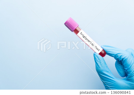 Blood sample tube with triglyceride cholesterol test label on medical laboratory technologist hands over blue background. Blood sample tube with triglyceride cholesterol test label on medical laboratory technologist hands over blue background. 136090841