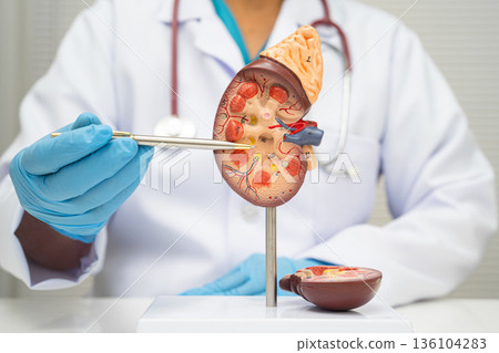 Chronic kidney disease, doctor with model for treatment urinary system, urology, Estimated glomerular filtration rate eGFR. 136104283