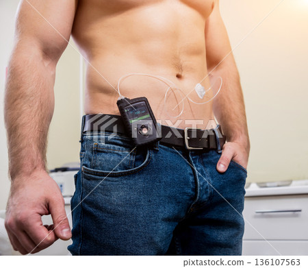 Diabetic man with an insulin pump connected in his abdomen Diabetic man with an insulin pump connected in his abdomen 136107563
