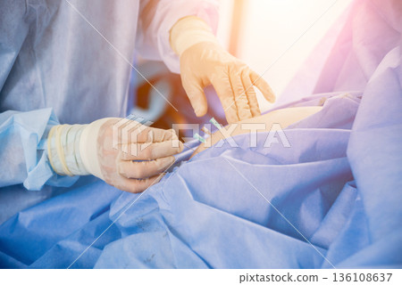 Arthroscope surgery. Orthopedic surgeons in teamwork in the operating room 136108637