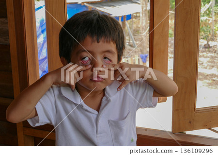 Asian Thai little boy make grimace eyes act like a ghost 136109296