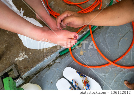 水母 腳 英尺 136112912