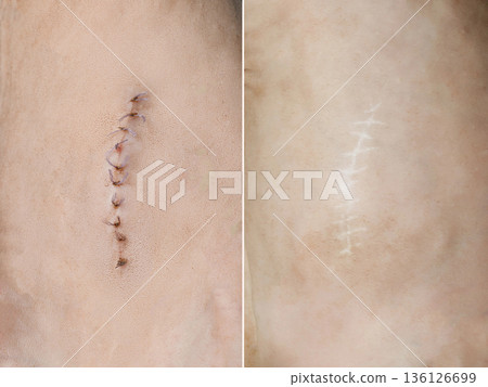 Surgical Suture after surgery or neutering and Scar after recovery. Skin close up Surgical Suture after surgery or neutering and Scar after recovery. Skin close up 136126699