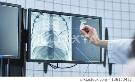Doctor operating on patient x-ray scan, performing a medical procedure Doctor operating on patient x-ray scan, performing a medical procedure 136133452
