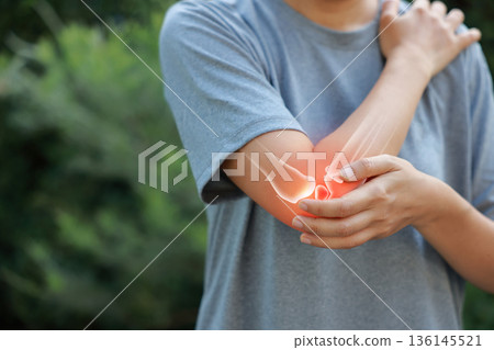 Close-up woman holding painful injured elbow with red inflamed spot and X-ray bone skeleton overlay. Medical concept of joint pain, fracture, arthritis, tendonitis, muscle injury, outdoor background. 136145521