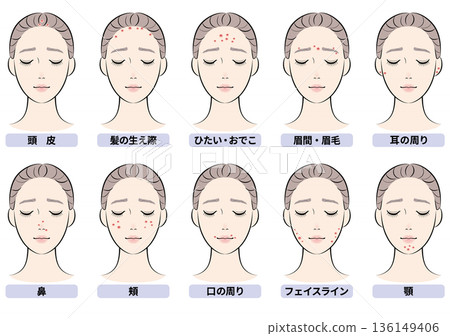 Acne-prone facial area set Acne-prone facial area set 136149406