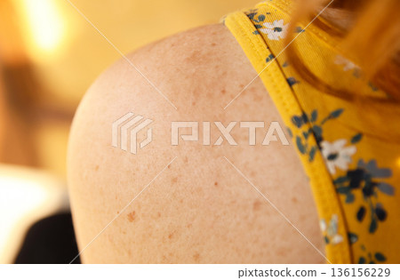 Close-up of woman freckled shoulder in yellow floral top, warm light. Macro freckled shoulder in floral dress, intimate beauty portrait. Natural Beauty, Skin Texture Close-up of woman freckled shoulder in yellow floral top, warm light. Macro freckled shoulder in floral dress, intimate beauty portrait. Natural Beauty, Skin Texture 136156229