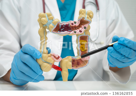 Intestine, doctor holding human model in hospital. Intestine, doctor holding human model in hospital. 136162855