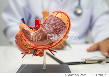 Stomach disease, doctor holding anatomy model. 136179094
