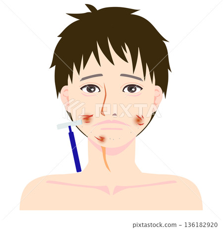 一個皮膚裸露的男人，正遭受剃鬚後皮膚灼傷的困擾。 136182920