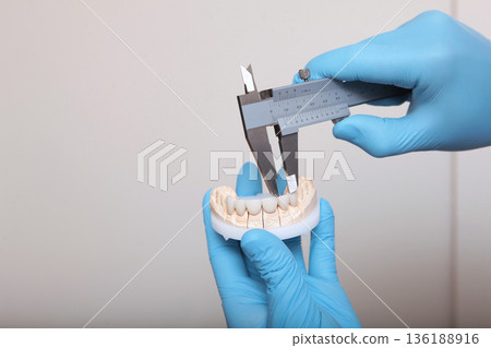 Ceramic and composite veneers. A dental technician makes the measurement of the veneers. Hands in protective gloves. The concept of beauty and health. Copy space. Close-up. 136188916