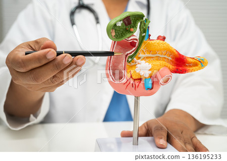 Pancreatitis, pancreatic cancer, Asian doctor with pancreas, gallbladder and bile duct human anatomy model at hospital. 136195233