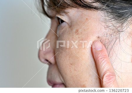 受臉部瑕疵、皺紋、雀斑、痣和疣困擾的老年女性 受臉部瑕疵、皺紋、雀斑、痣和疣困擾的老年女性 136220723