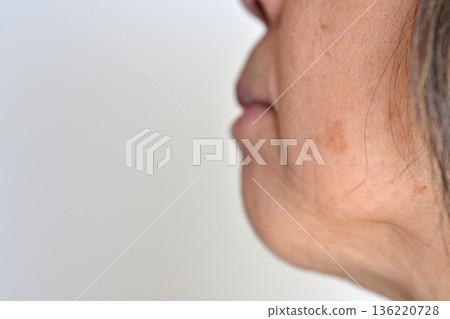 受臉部瑕疵、皺紋、雀斑、痣和疣困擾的老年女性 136220728