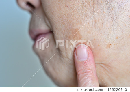 受臉部瑕疵、皺紋、雀斑、痣和疣困擾的老年女性 136220740