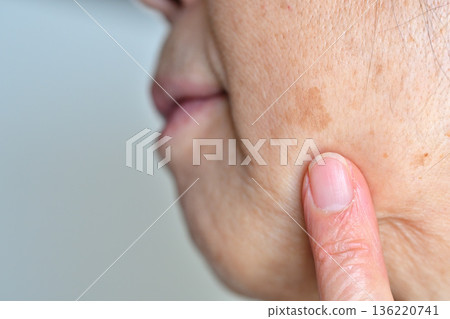 受臉部瑕疵、皺紋、雀斑、痣和疣困擾的老年女性 136220741
