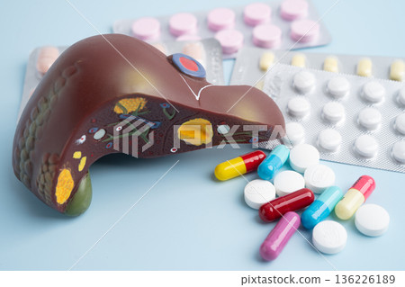 Liver model with pill drug treatment, Cirrhosis, Liver cancer, fatty liver. Liver model with pill drug treatment, Cirrhosis, Liver cancer, fatty liver. 136226189