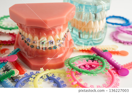 Orthodontic ligatures rings and ties, elastic rubber bands on orthodontic braces, model for dentist studying about dentistry. Orthodontic ligatures rings and ties, elastic rubber bands on orthodontic braces, model for dentist studying about dentistry. 136227003