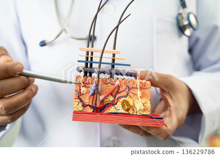 Hair transplant, Asian dermatologist doctor holding skin structure anatomy model for treatment in hospital. Hair transplant, Asian dermatologist doctor holding skin structure anatomy model for treatment in hospital. 136229786