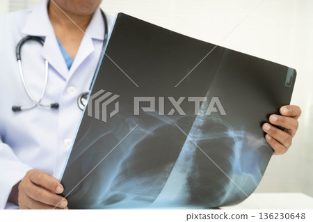 Doctor examining lung radiography xray film. 136230648