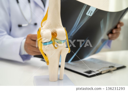 Doctor examining knee joint bone radiography xray film. 136231293