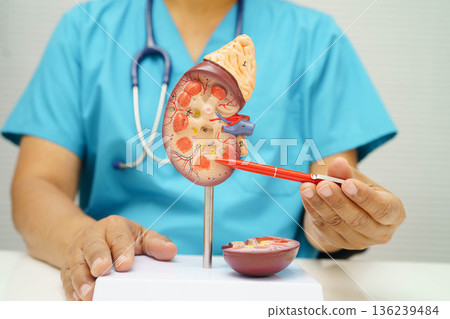 Chronic kidney disease, doctor with model for treatment urinary system, urology, Estimated glomerular filtration rate eGFR. 136239484