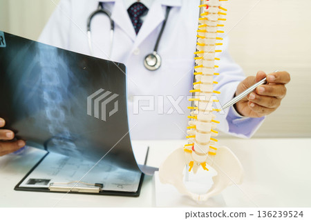 Doctor examining spine bone radiography xray film. 136239524