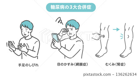 糖尿病三大併發症(Shimeji)(麻木、視網膜病變、腎病變)插圖集 糖尿病三大併發症(Shimeji)(麻木、視網膜病變、腎病變)插圖集 136262634