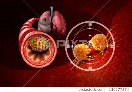 Lung Cancer Treatment 136277274