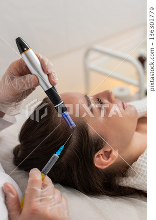Trichologist doing woman improve hair growth procedure, dermapen microneedling, vitamin injections 136301779