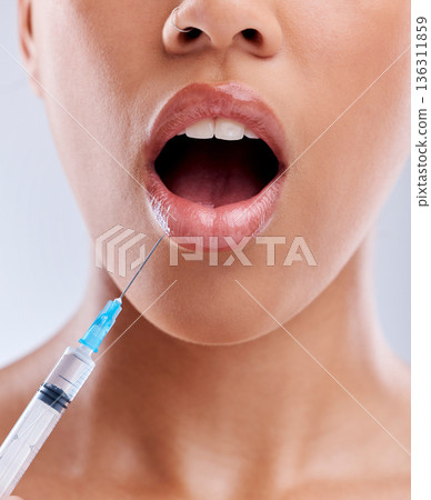 Lip filler, injection and beauty, woman with surprise and cosmetic surgery closeup on white background. Skincare, liquid collagen and female model with wow face, mouth and syringe with dermatology 136311859