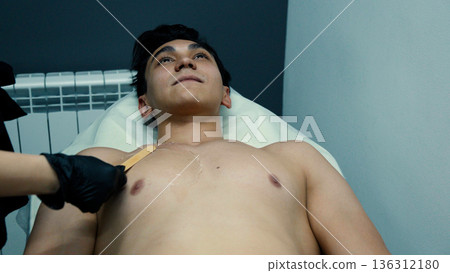 Male patient receiving chest hair removal procedure 136312180