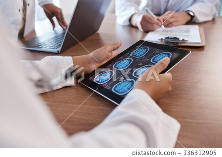 Doctor, tablet screen and hands of person with brain scan MRI, cancer tumor results and consulting on digital xray data. Closeup teamwork, radiology and neurosurgeon collaboration on anatomy exam Doctor, tablet screen and hands of person with brain scan MRI, cancer tumor results and consulting on digital xray data. Closeup teamwork, radiology and neurosurgeon collaboration on anatomy exam 136312905