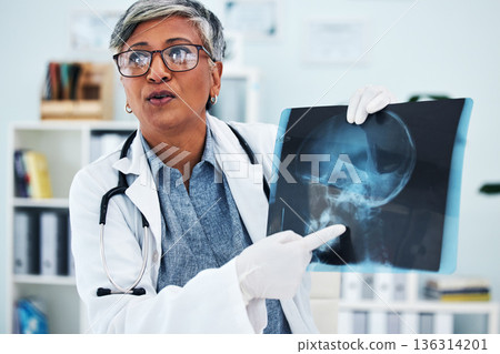 Hospital, doctor and senior woman with x ray for surgery, medical consultation and in diagnosis with patient. Healthcare, medicare and female health worker explain with head scan for injury analysis Hospital, doctor and senior woman with x ray for surgery, medical consultation and in diagnosis with patient. Healthcare, medicare and female health worker explain with head scan for injury analysis 136314201