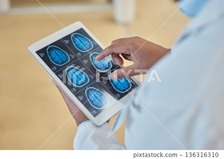 Brain scan, xray and closeup of a doctor with a tablet for a neurology consultation or surgery. Healthcare, digital technology and hands of surgeon analyzing a mri image in medical hospital or clinic 136316310