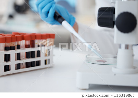 Hands, pipette and scientist with blood petri dish for research in laboratory. Science, medical professional and doctor with dropper for dna analysis, test and biology experiment to study dna sample. Hands, pipette and scientist with blood petri dish for research in laboratory. Science, medical professional and doctor with dropper for dna analysis, test and biology experiment to study dna sample. 136319865