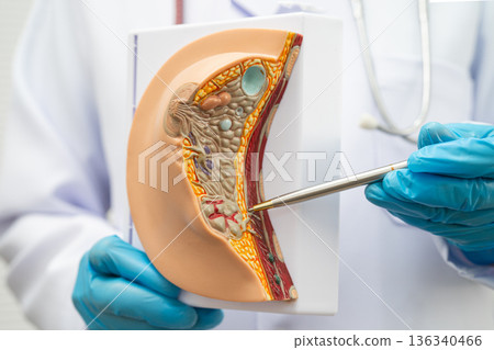 Doctor holding female breast human anatomy model. 136340466