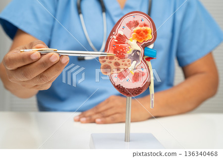Chronic kidney disease, doctor with model for treatment urinary system, urology, Estimated glomerular filtration rate eGFR. 136340468