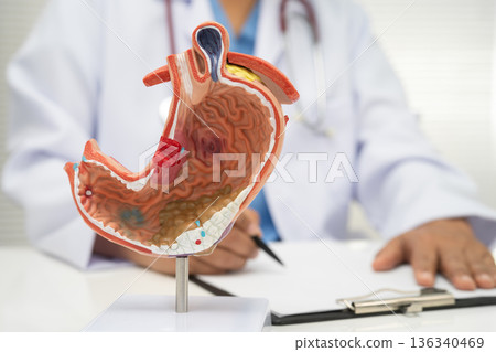 Stomach disease, doctor with anatomy model for study diagnosis and treatment in hospital. 136340469