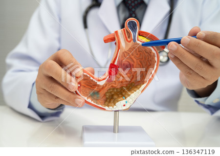 Stomach disease, doctor holding anatomy model for study diagnosis and treatment in hospital. 136347119