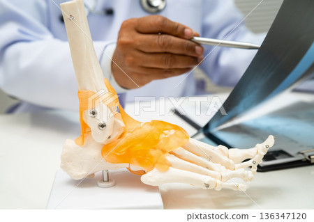Doctor examining foot ankle joint bone radiography xray film. Doctor examining foot ankle joint bone radiography xray film. 136347120