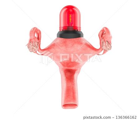 Uterus with red alarm light, gynecology emergency concept. 3D rendering Uterus with red alarm light, gynecology emergency concept. 3D rendering 136366162